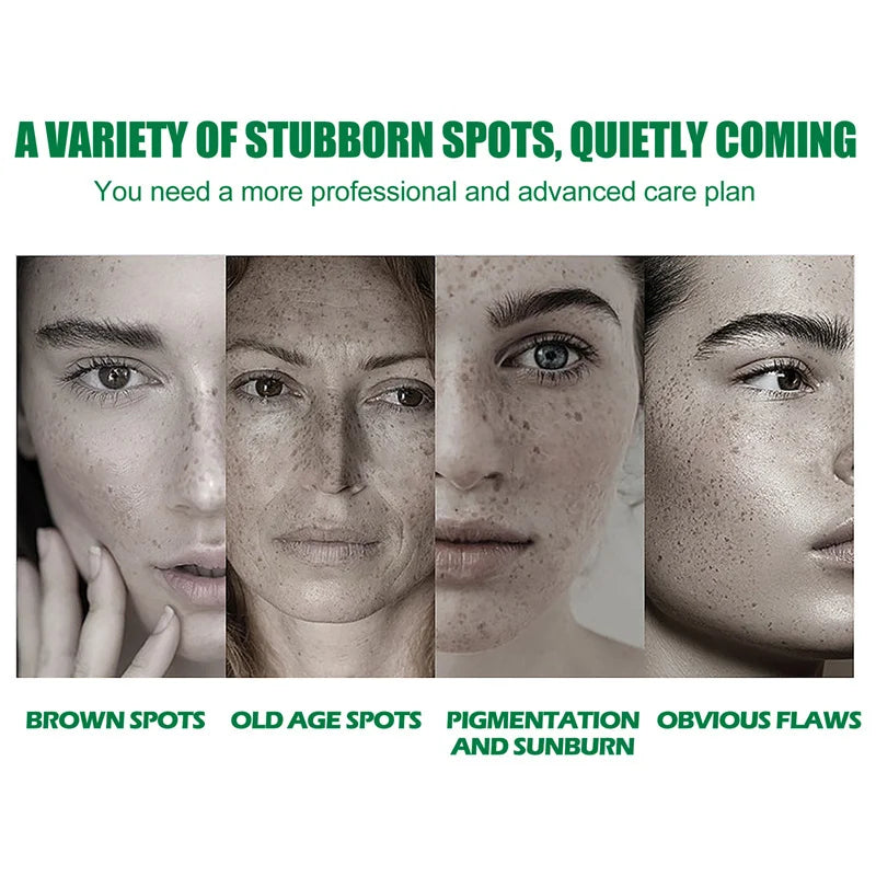 Dark Spots Remover Whitening Serum Face Freckle Melanin Correcting Anti Pigmentation Brightening
