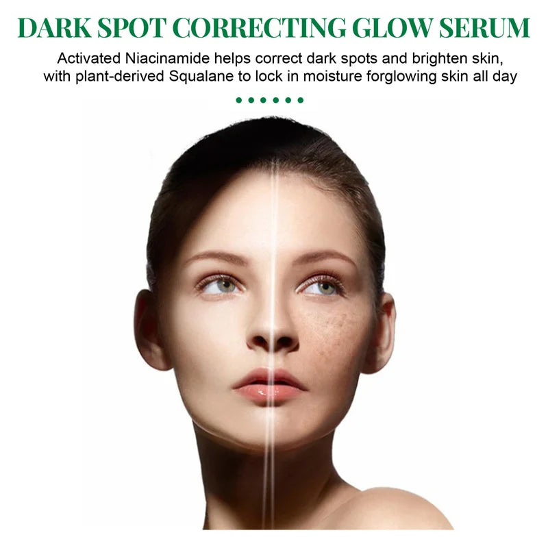 Dark Spots Remover Whitening Serum Face Freckle Melanin Correcting Anti Pigmentation Brightening