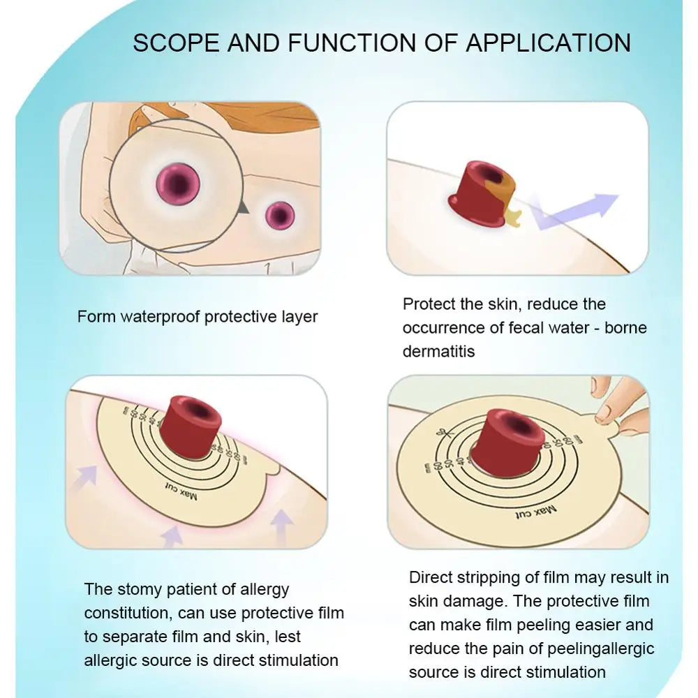 Recovery Skins Protective Film Nursing Tools Supply