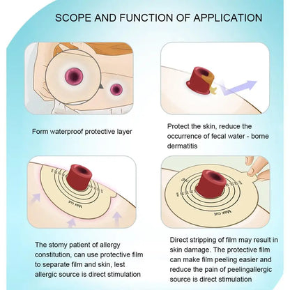 Recovery Skins Protective Film Nursing Tools Supply