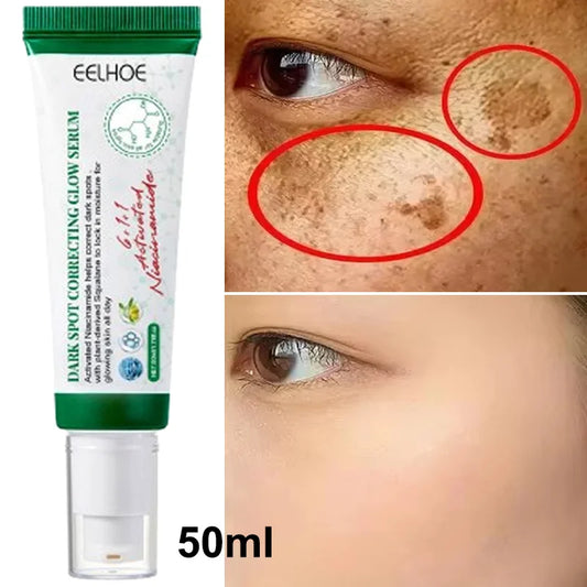 Dark Spots Remover Whitening Serum Face Freckle Melanin Correcting Anti Pigmentation Brightening