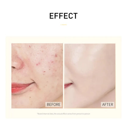 30pcs Sleeping Moisturizing Anti-aging Creams Mask