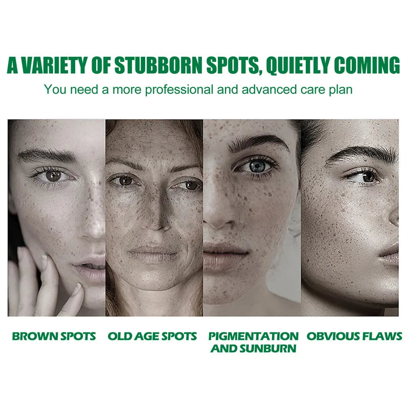 Dark Spots Remover Whitening Serum Face Freckle Melanin Correcting Anti Pigmentation Brightening