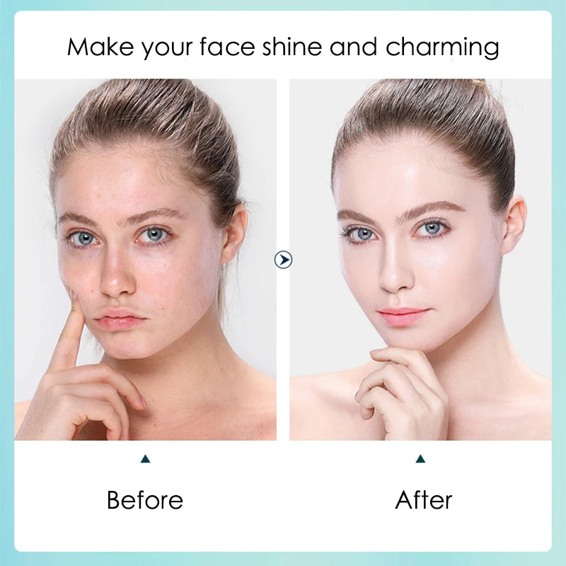 10pcs Hyaluronic Acid Facial Mask Sheet