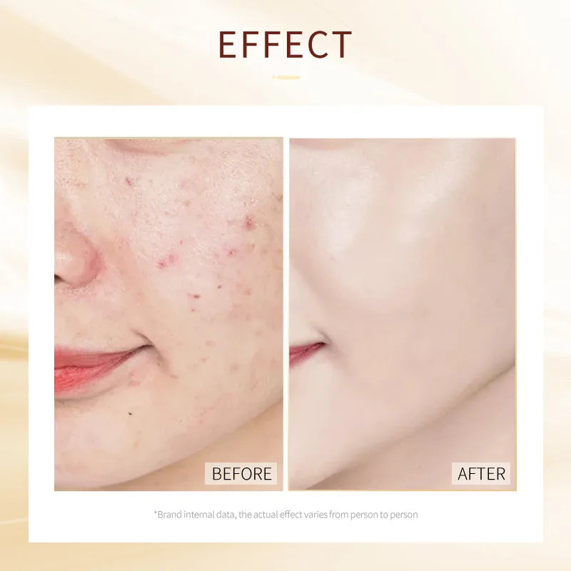 30pcs Sleeping Moisturizing Anti-aging Creams Mask