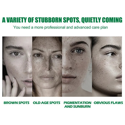 Dark Spots Remover Whitening Serum Face Freckle Melanin Correcting Anti Pigmentation Brightening