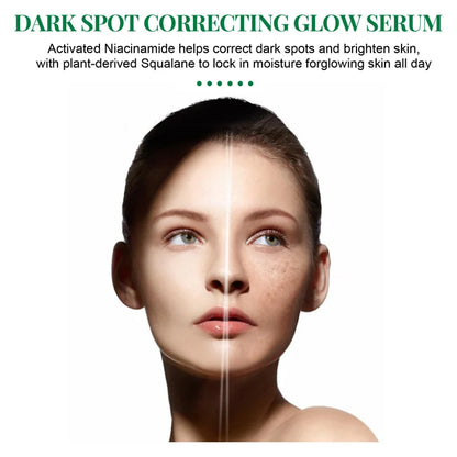 Dark Spots Remover Whitening Serum Face Freckle Melanin Correcting Anti Pigmentation Brightening